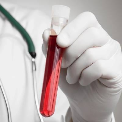 MOBILE PHLEBOTOMY SERVICES